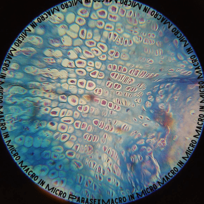 MACRO IN MICRO