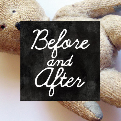 Before and After