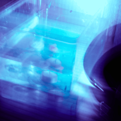 Negative mind