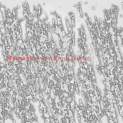 MentalAnswer From Noise