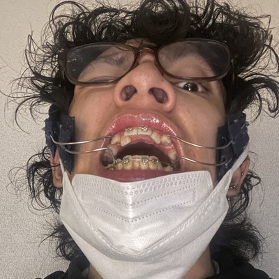 HOTEL Forest inn Kyle