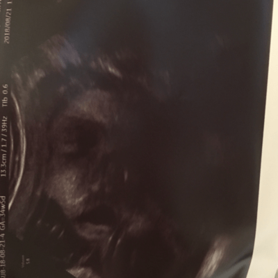 FOR TOMMOROW (NEW MALE VOCAL Ver.)