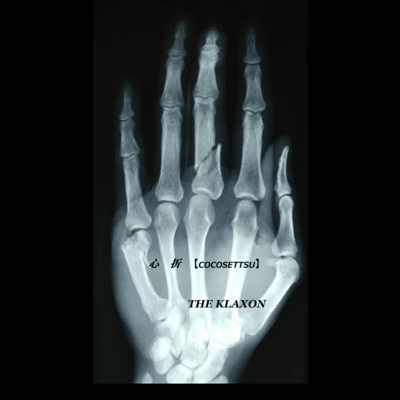 Be snapped my heart (2025 Remastered)