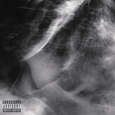 fff (feat. Brokeboishit)