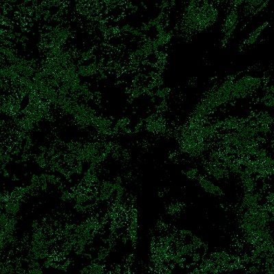 GREEN SYNDROME by mongolian drivin press