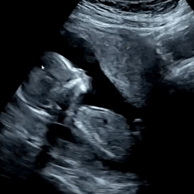 I'll be a mother
