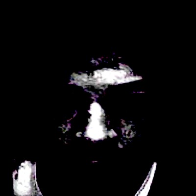 Delusions and thoughts