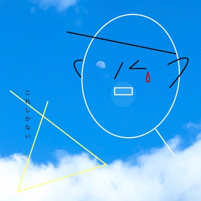 this is the only option