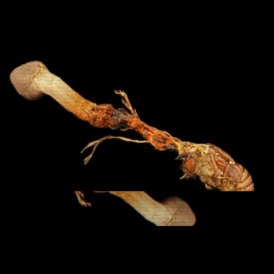 parasite